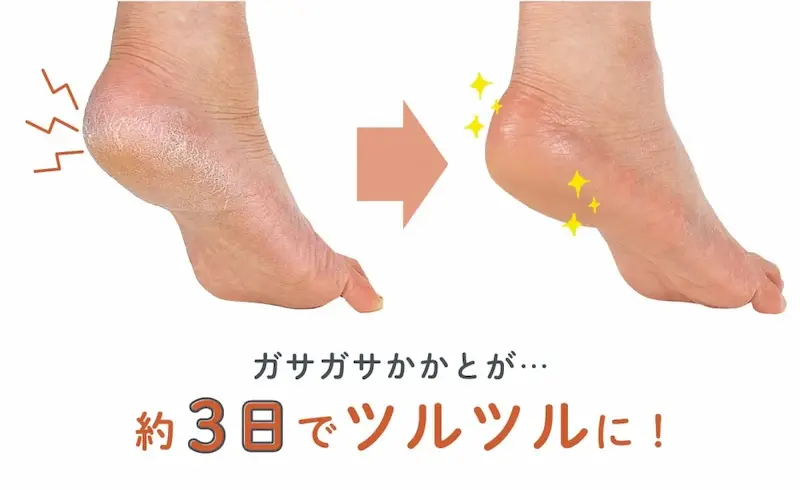 ガサガサかかとが約3日でツルツルに